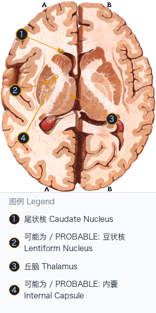 基底核轴位空间定位 Basal Nuclei Axial Locator — Annotated / 标注图