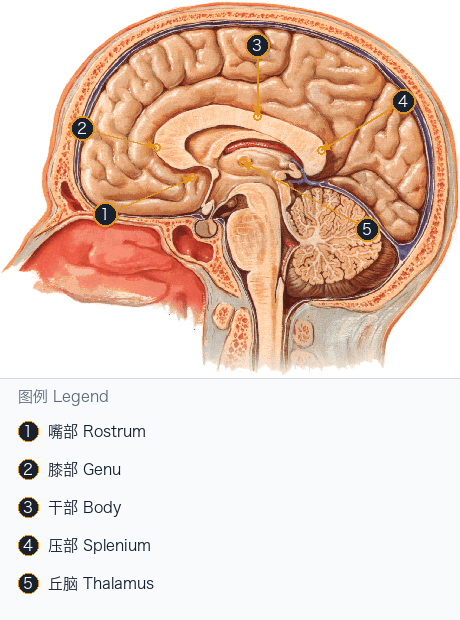 胼胝体矢状位空间定位 Corpus Callosum Sagittal Locator — Annotated / 标注图