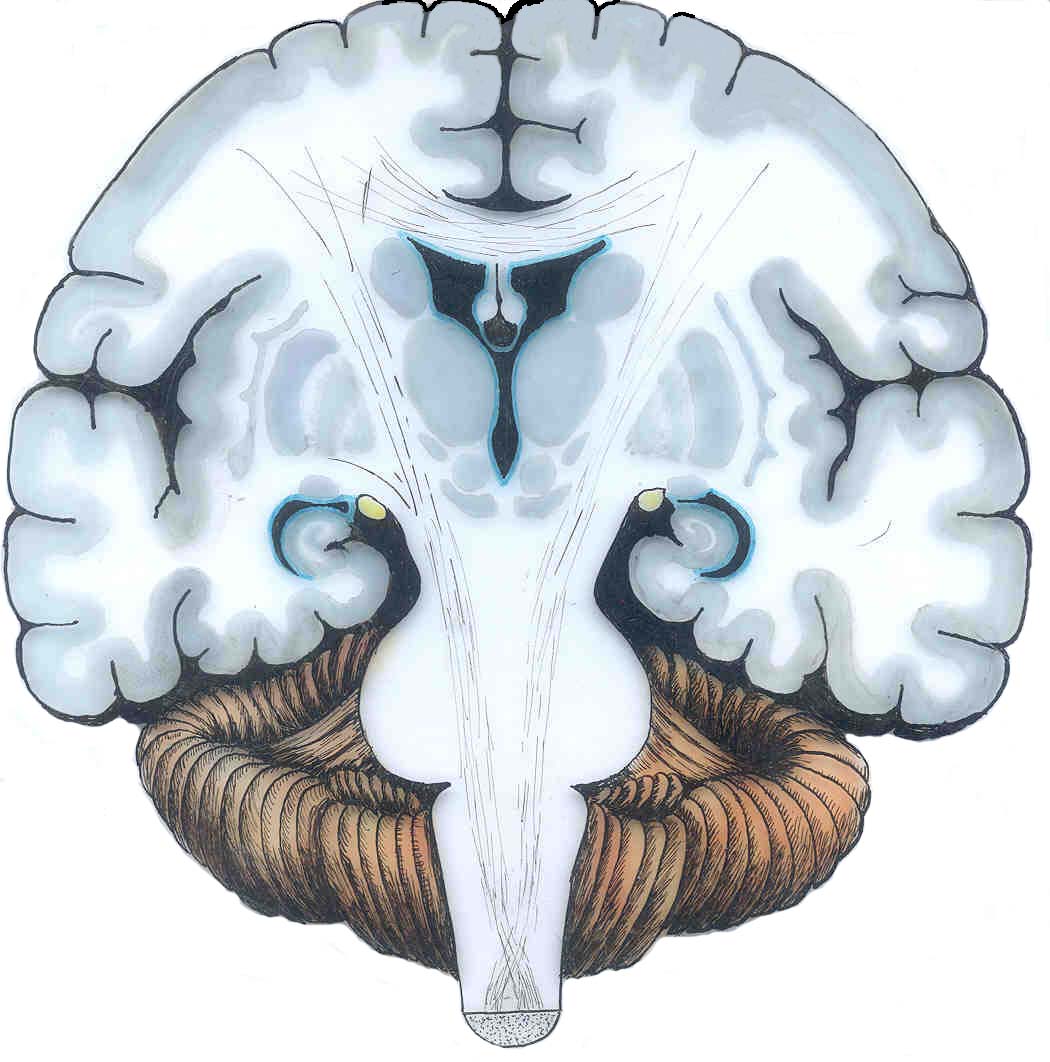 丘脑—第三脑室—内囊 Thalamus–Third Ventricle–Internal Capsule — Original / 原图