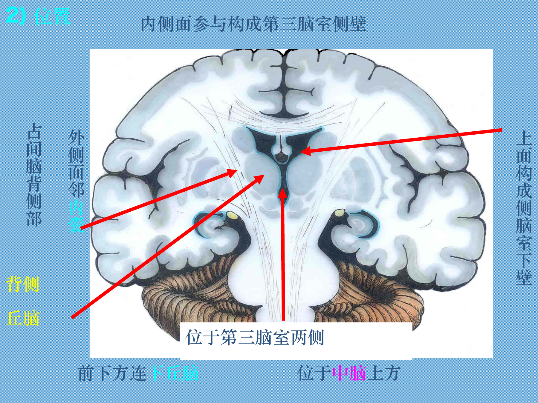 冠状切面:丘脑与内囊